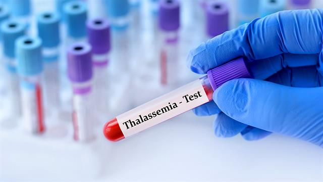 Γονιδιακή θεραπεία για ασθενείς με εξαρτώμενη από μεταγγίσεις μεσογειακή αναιμία: Τέλος εποχής