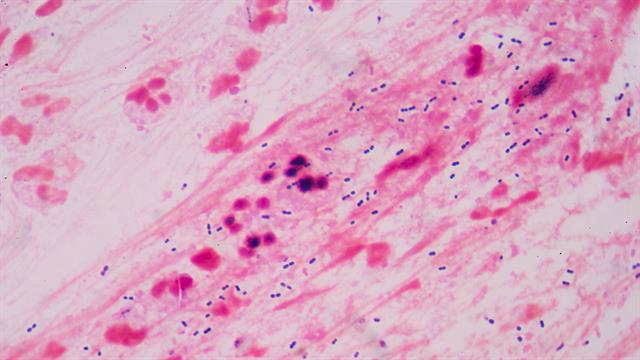 Ανανεώσιμα πλαστικά με τη βοήθεια μικροβίων