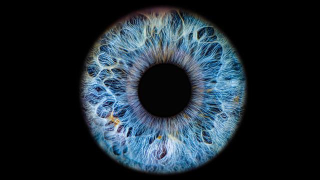 Ιδιοπαθής ενδοκράνια υπέρταση: Εντοπίστηκαν προειδοποιητικά σημάδια απώλειας όρασης