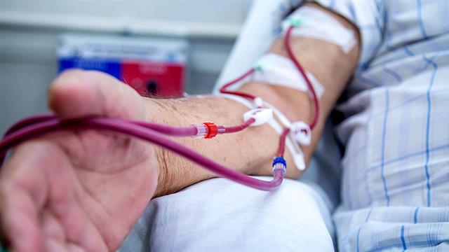 Τι είναι η αιμοκάθαρση - Πώς γίνεται η περιτοναϊκή κάθαρση και η αρτηριακή παράκαμψη