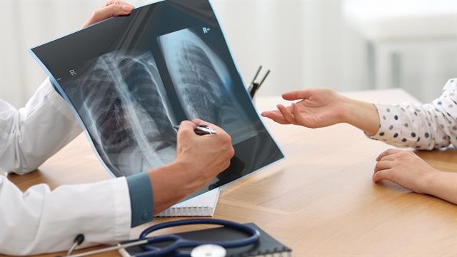 Διεθνής Ημέρα Ακτινολογίας - Η συμβολή της Ακτινολογίας στην ιατρική πράξη
