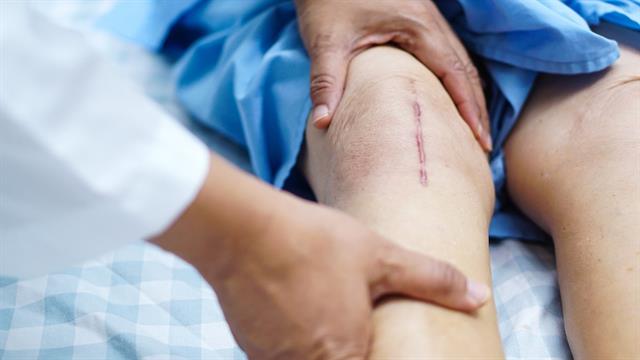 Πώς αντιμετωπίζουμε την ουλή στο δέρμα