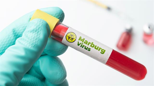 Τρείς θάνατοι από τον ιό Marburg στην Αιθιοπία