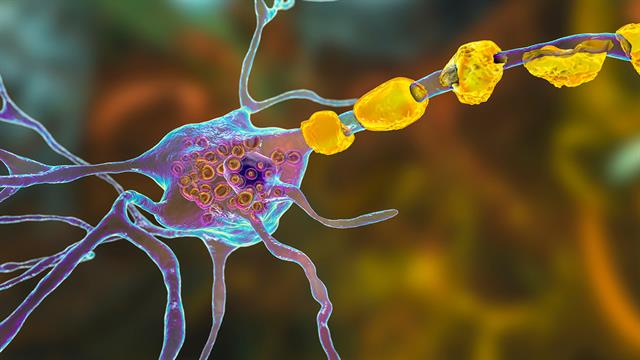 Kενό μεταξύ παιδιατρικής και ενήλικης φροντίδας για τους ασθενείς με σπάνια λυσοσωμικά νοσήματα