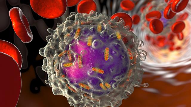 Μηχανισμός κυτταρικής προστασίας προστατεύει από την οξεία μυελογενή λευχαιμία