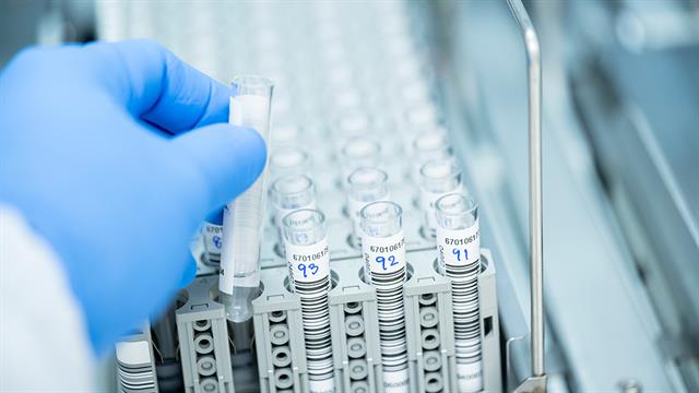 Θάνατος από γρίπη: Πώς θα μπορούσε να αποφευχθεί το σημείο καμπής (μελέτη)