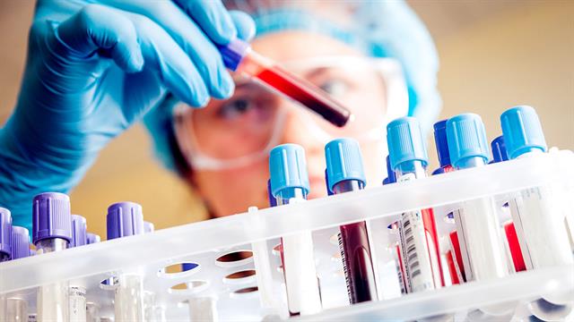 Nέα θεραπευτική προσέγγιση για τον καρκίνο του αίματος (Μελέτη)