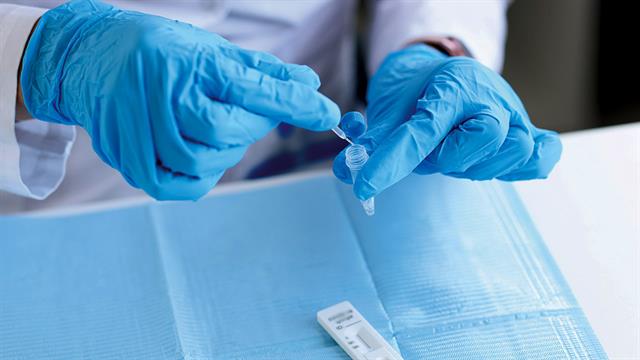 Νέο rapid test για την ηπατίτιδα C δίνει αποτελέσματα σε 15 λεπτά [μελέτη]