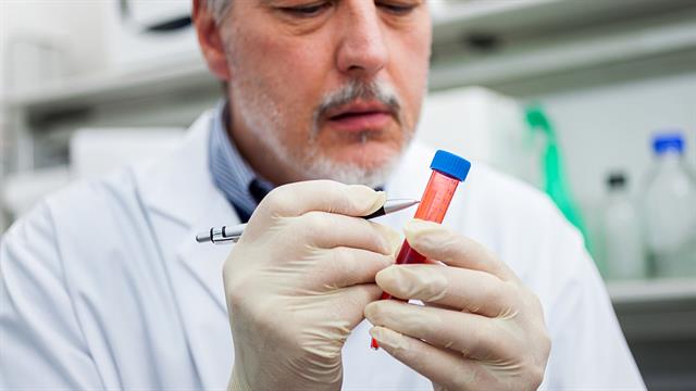 Αναπτύχθηκε τεστ για διάγνωση της ALS με ακρίβεια 97%