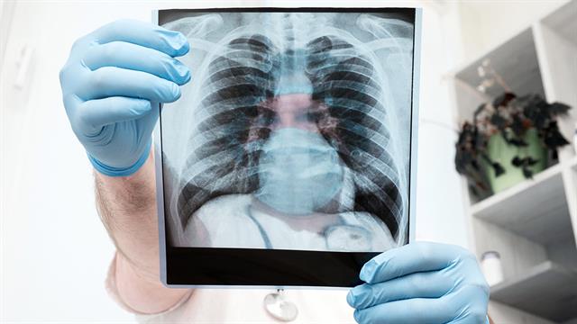 Νέο φάρμακο κατά των ανθεκτικών βακτηρίων της φυματίωσης