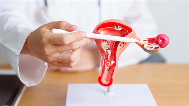 Ο καρκίνος των ωοθηκών καταλαμβάνει ένα ολόκληρο όργανο στην κοιλιακή χώρα