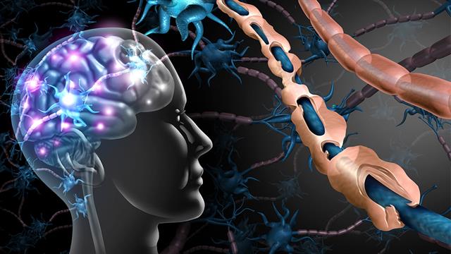 Η εγκυμοσύνη προστατεύει από την πολλαπλή σκλήρυνση