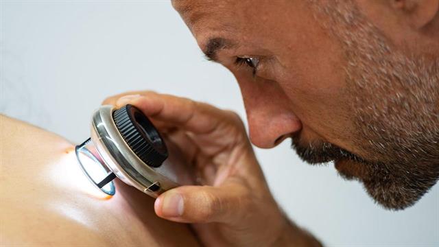 Μελάνωμα: Συνδυαστική θεραπεία μειώνει τον κίνδυνο υποτροπής ή θανάτου