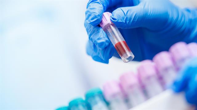 Πρώιμα σημάδια της νόσου του Πάρκινσον μπορούν να εντοπιστούν στο αίμα [μελέτη]