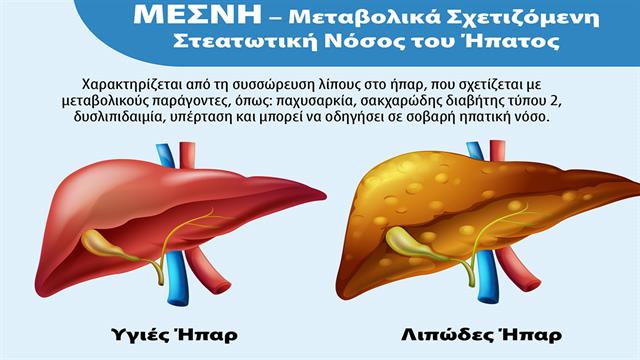 Hepatrat της UNI-PHARMA: Ευρωπαϊκή πατέντα και νέα δημοσίευση για τη συμβολή του σε ασθενείς με λιπώδες ήπαρ