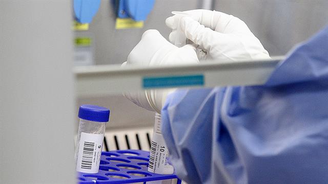 Νέα ανοσοθεραπεία μειώνει αθηροσκληρωτικές πλάκες σε ποντίκια