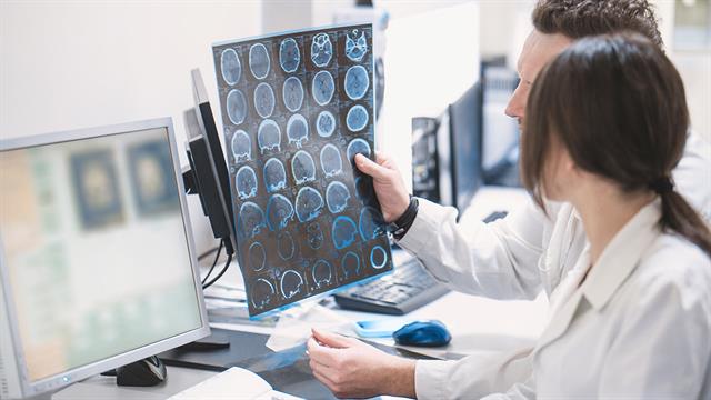 Εγκεφαλικό επεισόδιο: Σημαντική δευτερογενής πρόληψη με νέα θεραπεία