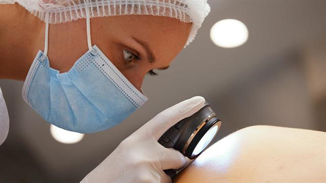 Μελάνωμα: Σημαντική μείωση της υποτροπής με εμβόλιο mRNA - ανοσοθεραπεία