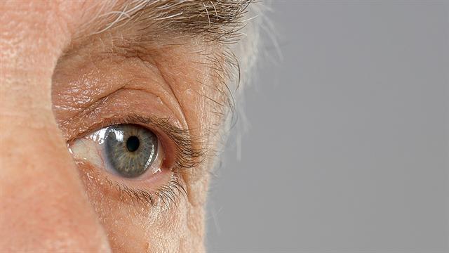 Κοινό βακτήριο αναπνευστικών λοιμώξεων εντοπίστηκε στα μάτια ασθενών με Αλτσχάιμερ