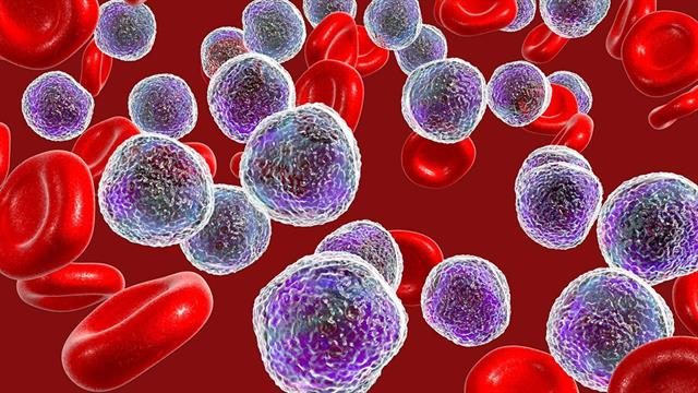 Εξελίξεις σε διάγνωση - θεραπεία σπάνιων αιματολογικών νεοπλασμάτων