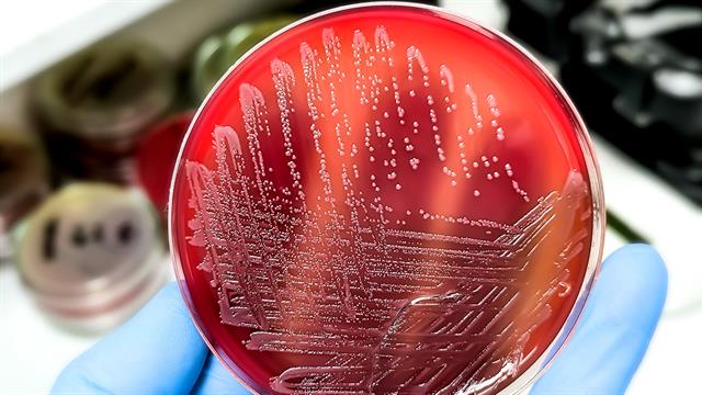 ΕΟΦ: Συμπλήρωμα διατροφής συνδέεται με επιδημία σαλμονέλωσης