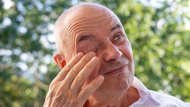 H ξηροφθαλμία  μπορεί να κρύβει αυτοάνοσο νόσημα (μελέτη)