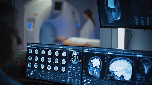 Σύγχρονη αξονική εντοπίζει τον καρκίνο του πνεύμονα με ακρίβεια και λιγότερη ακτινοβολία