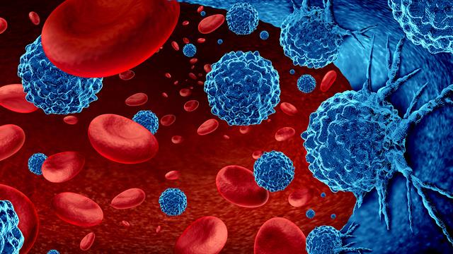 Πολλαπλό μυέλωμα: Νέα γενιά φαρμάκων δημιουργεί ελπίδες