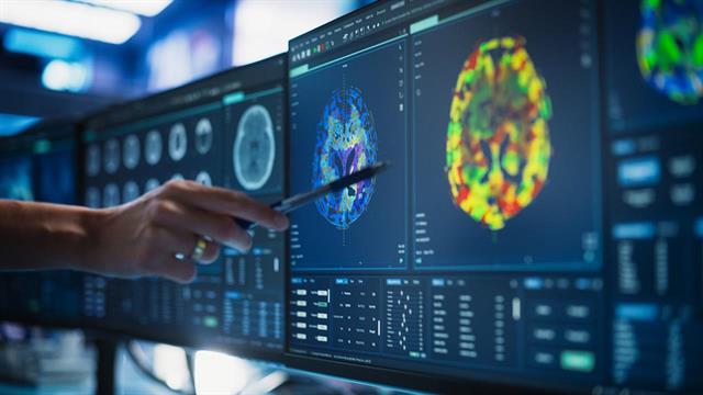 Η Εταιρεία Αγγειακών Εγκεφαλικών Νόσων για την εκπαίδευση στην Επεμβατική Νευροακτινολογία