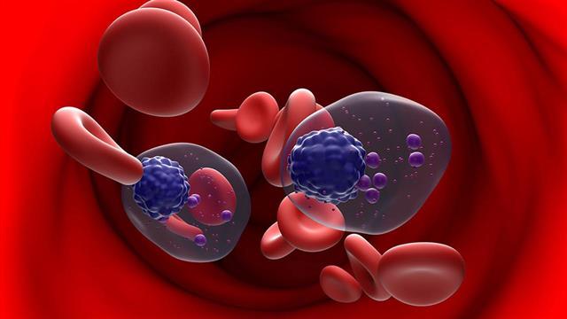 ΕΚΠΑ: Πού τρέχουν κλινικές μελέτες για το πολλαπλό μυέλωμα - Μάρτιος, μήνας ευαισθητοποίησης