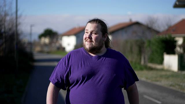 Παχυσαρκία: Μια χρόνια νόσος που απαιτεί σύγχρονη ιατρική προσέγγιση