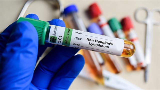 Προχωρημένο θυλακιώδες λέμφωμα: Πιθανή θεραπεία για χρόνιους ασθενείς