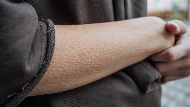 Γιατί ανατριχιάζουμε