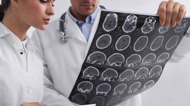 Νεότερα θεραπευτικά δεδομένα για την Πολλαπλή Σκλήρυνση, στο τέλος του πρώτου τετάρτου του 21ου αιώνα