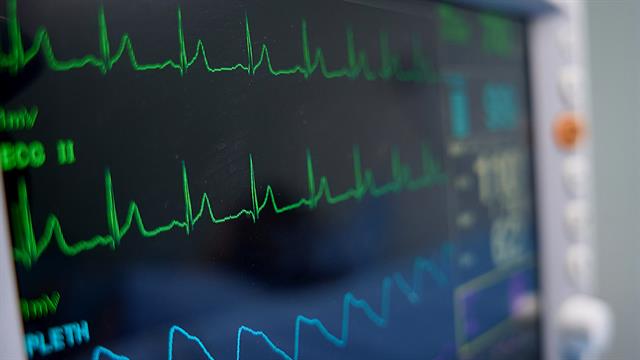 Επέμβαση - ελπίδα για σωτηρία από τις καρδιακές αρρυθμίες