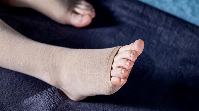 Εν τω βάθει φλεβική  θρόμβωση και στέντς