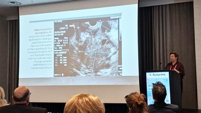 Ραδιοϊσότοπα φωσφόρου κατά του καρκίνου του παγκρέατος - Τι έδειξε η εφαρμογή σε 17 ασθενείς