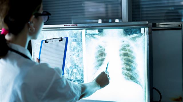Νέα θεραπευτική προσέγγιση για την πνευμονική εμβολή δίνει ελπίδες
