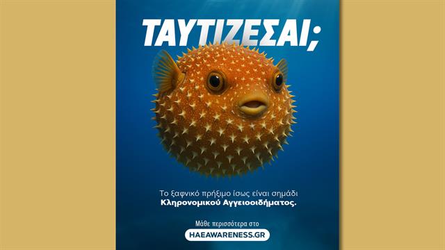 ‘’Ταυτίζεσαι;’’: Η CSL στο πλευρό των ασθενών με Κληρονομικό Αγγειοοίδημα