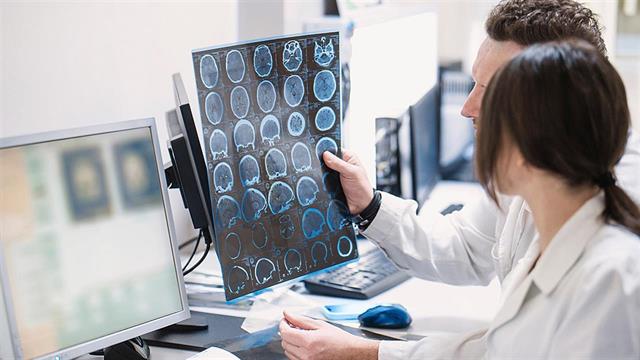 Χαμηλή πίεση και Alzheimer: Τι αποκαλύπτει νέα μελέτη