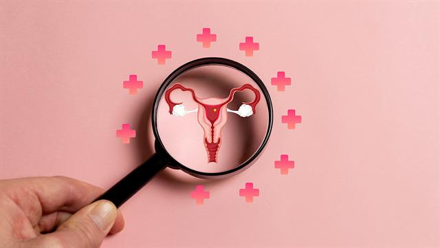 Χρονικά περιορισμένη λήψη τροφής και Σύνδρομο πολυκυστικών ωοθηκών