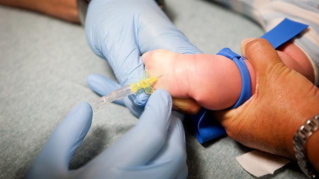 Γενετικός έλεγχος στο αίμα της φτέρνας μπορεί να εντοπίσει παιδιά με αυξημένο κίνδυνο καρκίνου