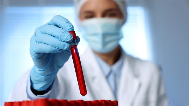 Πώς απομακρύνονται χημικές ουσίες  και νανοπλαστικά από το αίμα [μελέτη]