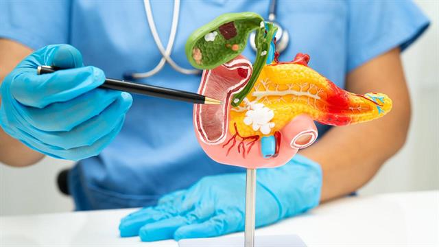 Ο FDA εγκρίνει φάρμακο που αναμένεται να μεταμορφώσει τη φροντίδα για τον καρκίνο του παγκρέατος