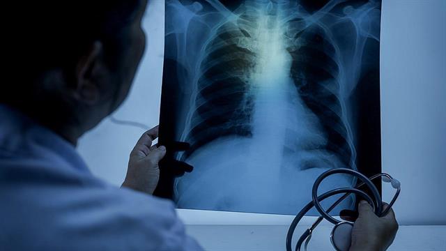 Τον ιστότοπο inosi.gr παρουσίασε η Ελληνική Πνευμονολογική Εταιρεία