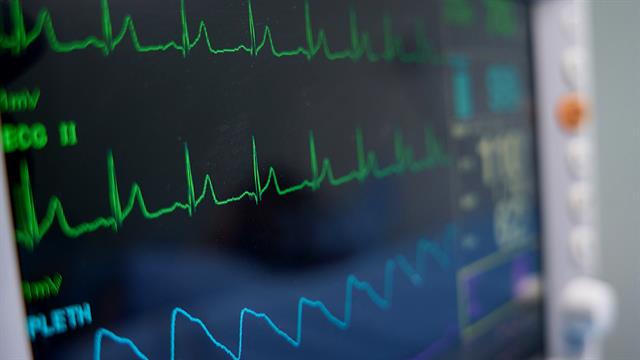 Καρδιακές αρρυθμίες: Πότε το «φτερούγισμα» είναι ύποπτο
