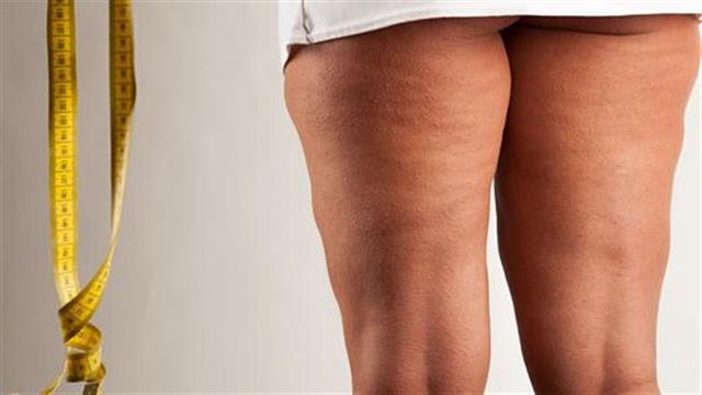 Καταπολέμηση της κυτταρίτιδας με ηλεκτροβελονισμό