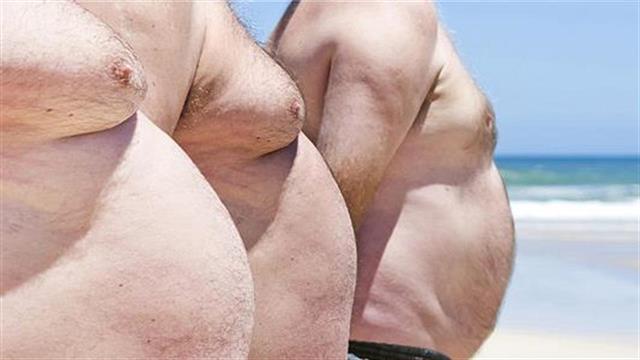 Η παχυσαρκία οδηγεί και σε οστεοπόρωση