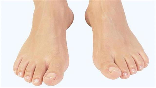 Γνωρίστε τους παράγοντες κινδύνου για ουρική αρθρίτιδα