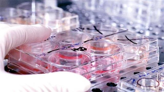 Διαγνωστικά κέντρα: Διευκρινήσεις για τα πληθυσμιακά κριτήρια